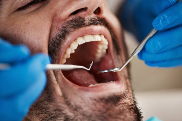 Best Emergency Dental Care for Sports Injuries in Delhi, LA