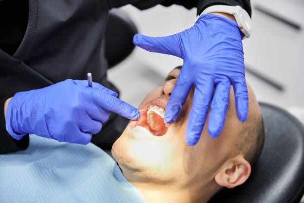 Best Lost Filling or Crown Replacement in Delhi, LA